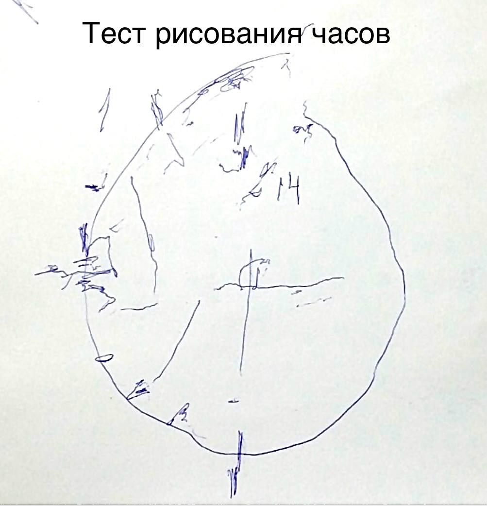 Пациент 60 лет